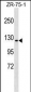 ERN1 Antibody (C-term)