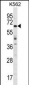 TRIM75 Antibody (Center)