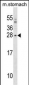 SIX6 Antibody (Center)