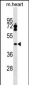 LPXN Antibody (Center)