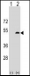 LPXN Antibody (Center)