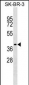 TRAM1 Antibody (C-term)