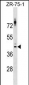 NKX2-1 Antibody (Center)