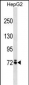 MOXD1 Antibody (N-term)