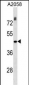 THOC3 Antibody (N-term)