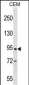 DPP4 Antibody (Center)