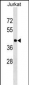 HLA-C Antibody (Center)