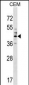 CEACAM6 Antibody (Center)