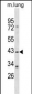 RASSF1 Antibody (Center)