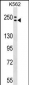 ADCY9 Antibody (C-term)