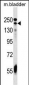 ADCY9 Antibody (C-term)