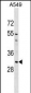 AQP1 Antibody (C-term)