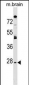 AQP1 Antibody (C-term)