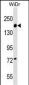 ITGA2 Antibody (C-term)