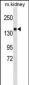 ITGA2 Antibody (C-term)