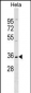 ELOVL1 Antibody (N-term)