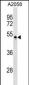 PVRL4 Antibody (Center)