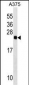 RAB2B Antibody (Center)