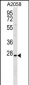 TRIM74 Antibody (C-term)