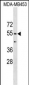 CORO1B Antibody (C-term)