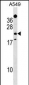 EFHD1 Antibody (Center)