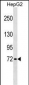 GBP4 Antibody (Center)