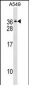 GEMIN8 Antibody (C-term)