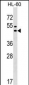 GPR20 Antibody (C-term)