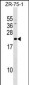 GRPEL1 Antibody (Center)