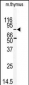 MARK2 (EMK) Antibody (C-term)