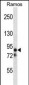 MARK2 (EMK) Antibody (C-term)