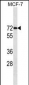 ESR1/ER Antibody