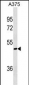 AKT1S1 Antibody