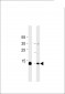 Myoglobin Antibody