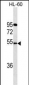 FKRP Antibody (C-term)