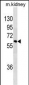 SPRED1 Antibody