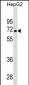 PDK3 Antibody (Ascites)