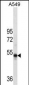 RUVBL1 Antibody