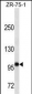 FUT4 Antibody