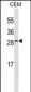 CRP Antibody (Ascites)