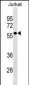 CD1A Antibody (Ascites)