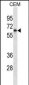 FCGR3A Antibody (Ascites)