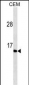 GAST Antibody(Ascites)