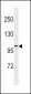 FGA Antibody (N-term)