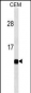 B2M Antibody (Ascites)