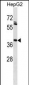 IGHG1 Antibody (Ascites)