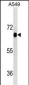 DYRK2 Antibody