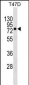 MX1 Antibody