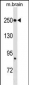 FASN Antibody (Center)