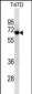 ALB Antibody